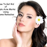 How To Get Rid of Pimple Acne Marks Using Home Remedies