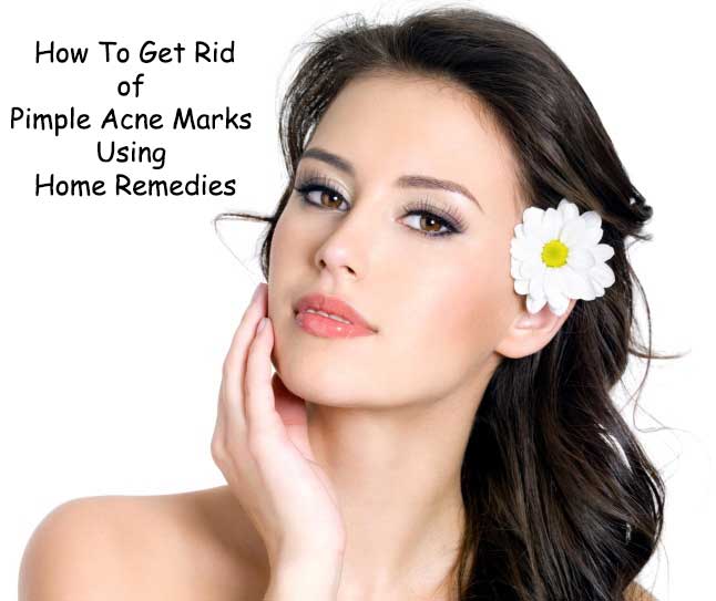  How To Get Rid of Pimple Acne Marks Using Home Remedies